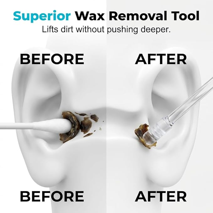 Sticky Ear Cleaning Stick, 2026 Upgrad Ear Wax Removal Tool for Adults (48pcs, Large) | Sticky Ear Cleaner Picks with Soft Rubber Head, Washable Reusable Adhesive Earwax Cleaning Tools for Daily Ear Care