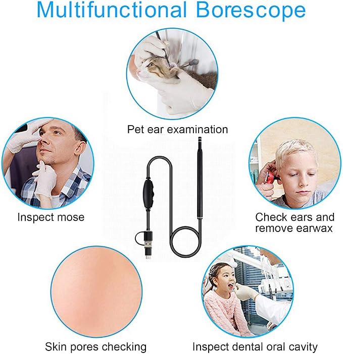 Ear Wax Removal - 3 in1 USB Earwax Removal Tool HD Ear Cleaner Endoscope with 6 LED Light, Earwax Remover Tool, Visual Ear Camera Ear Pick Cleaning Kit for Adults Kids Pets by Android Smart Phones
