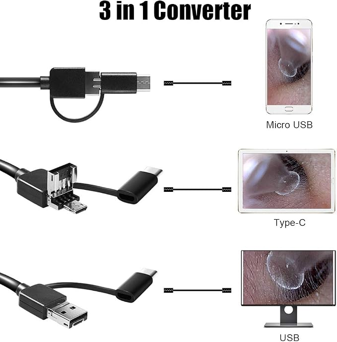 Ear Wax Removal - 3 in1 USB Earwax Removal Tool HD Ear Cleaner Endoscope with 6 LED Light, Earwax Remover Tool, Visual Ear Camera Ear Pick Cleaning Kit for Adults Kids Pets by Android Smart Phones