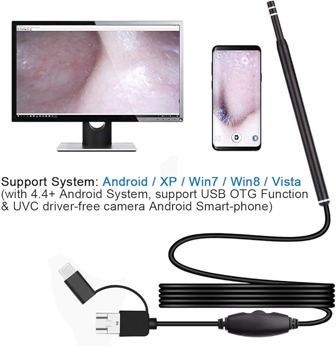 Ear Wax Removal - 3 in1 USB Earwax Removal Tool HD Ear Cleaner Endoscope with 6 LED Light, Earwax Remover Tool, Visual Ear Camera Ear Pick Cleaning Kit for Adults Kids Pets by Android Smart Phones