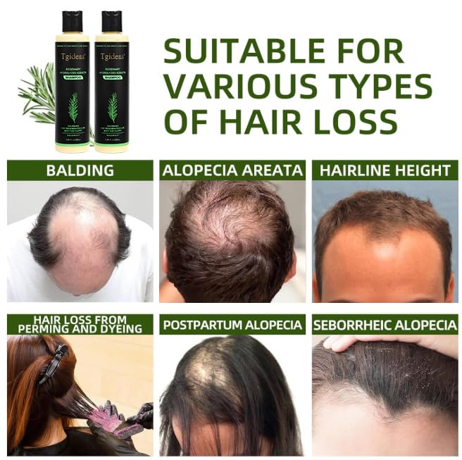 Rosemary Hair Growth Shampoo for Women and Men-Natural Thickening & Strengthening Shampoo with Hydrolyzed Keratin for Thinning Hair & Hair Loss 7.4 fl.oz - 2 Packs
