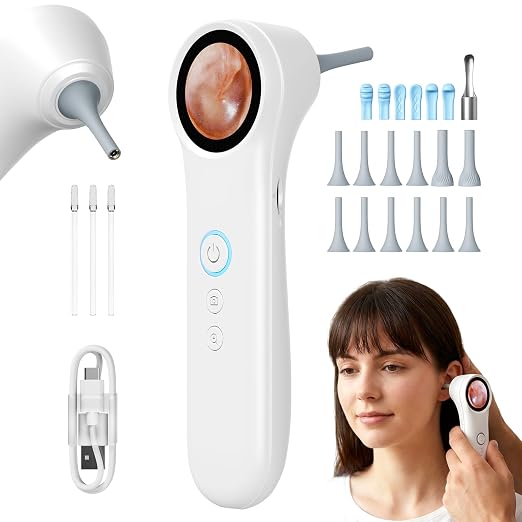 Ear Camera with 1.21” Screen, 1080P HD Digital Otoscope Ear Scope with 4 LED Lights, Skin Inspection Probe, 10 Ear & Nose Tips, 6 Ear Pick Tools, Ear Cleaner for Adults Kids Pets, Type-C