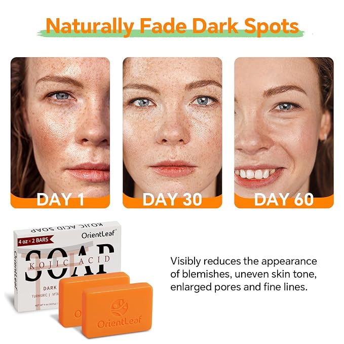 ORIENTLEAF Kojic Acid and Turmeric Soap for Dark Spots Remover, Brightening, Hyperpigmentation for Face, 4oz x 2 BARS