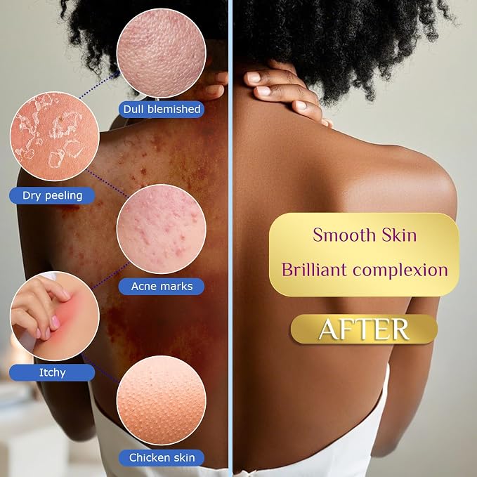 2 Pieces African Net Sponge – Effective Deep Cleansing and Exfoliating Mesh for Glowing Skin – Stretchable, Quick-Dry Exfoliating Bath Sponge (Blue)