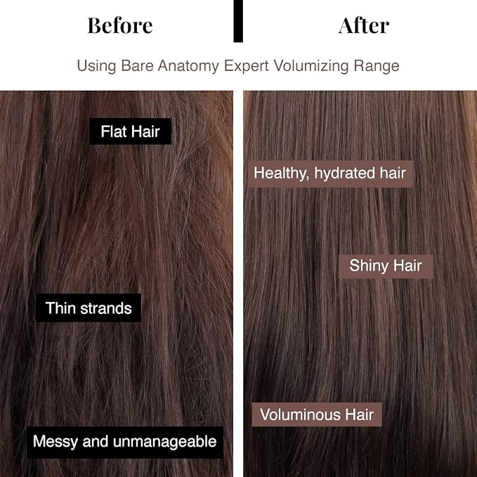 Bare Anatomy Volumizing Shampoo | For Fine Hair - Adds Lift & Body, Volumizing & Detangling Without Weighing Down | Paraben & Sulphate Free | Women & Men | 8.4 Ounce