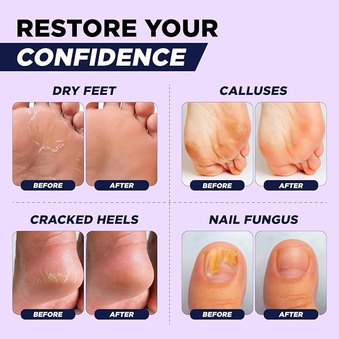 FOOT CURE Tea Tree Oil & Soothing Lavender Foot Soak with Epsom Salt - Best Toenail Treatment & Softens Calluses - Soothes Sore & Tired Feet, Foot Odor Scent, Spa Pedicure - 16 oz (Pack of 2)