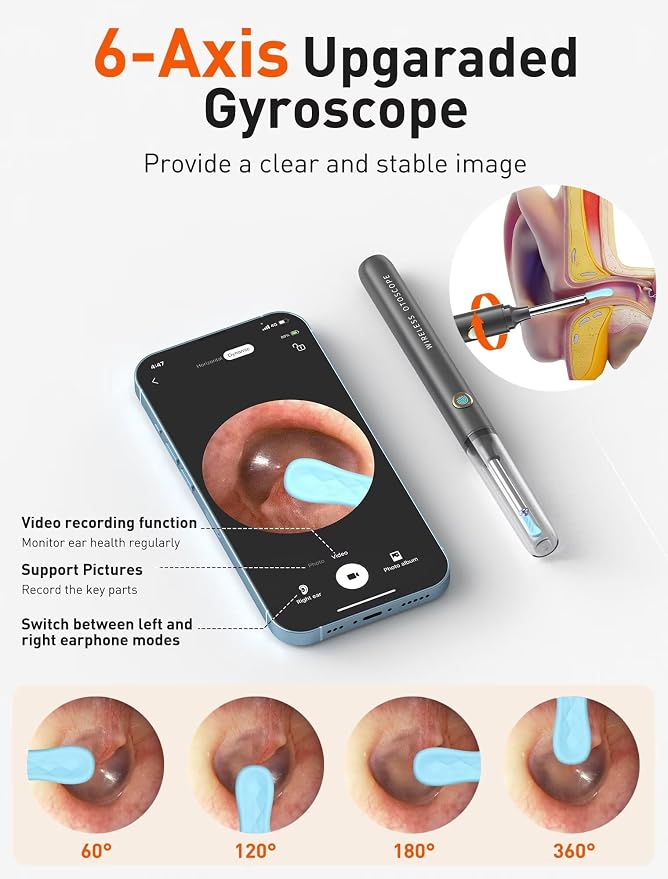 Ear Wax Removal Tool Camera - Ear Cleaner with 1080P HD Camera, FSA HSA Store Eligible, Otoscope with Light, Earwax Removal Kit with Replacement Tips for iPhone, iPad, Android Phones (Gray)