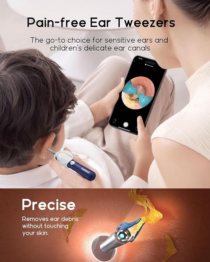 Bebird Earsight Plus D39R Ear Wax Removal Tool Camera, FSA HSA Eligible Items, Ear Cleaner with Flexible Ear Camera Otoscope, Visual Ear Pick Tweezers Wax Remover, Ear Cleaning Kit for Family