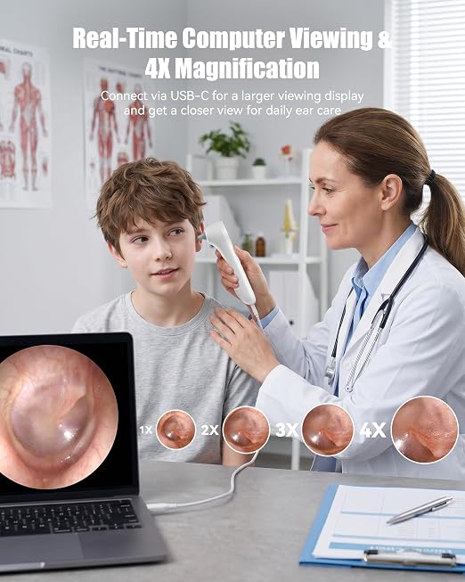 Ear Camera with 1.21” Screen, 1080P HD Digital Otoscope Ear Scope with 4 LED Lights, Skin Inspection Probe, 10 Ear & Nose Tips, 6 Ear Pick Tools, Ear Cleaner for Adults Kids Pets, Type-C