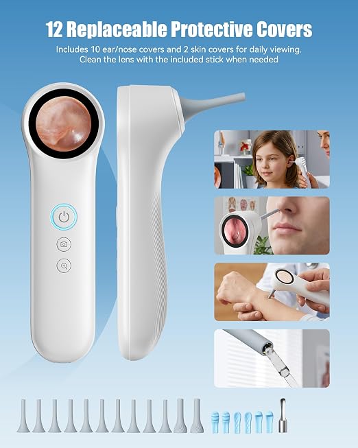 Ear Camera with 1.21” Screen, 1080P HD Digital Otoscope Ear Scope with 4 LED Lights, Skin Inspection Probe, 10 Ear & Nose Tips, 6 Ear Pick Tools, Ear Cleaner for Adults Kids Pets, Type-C