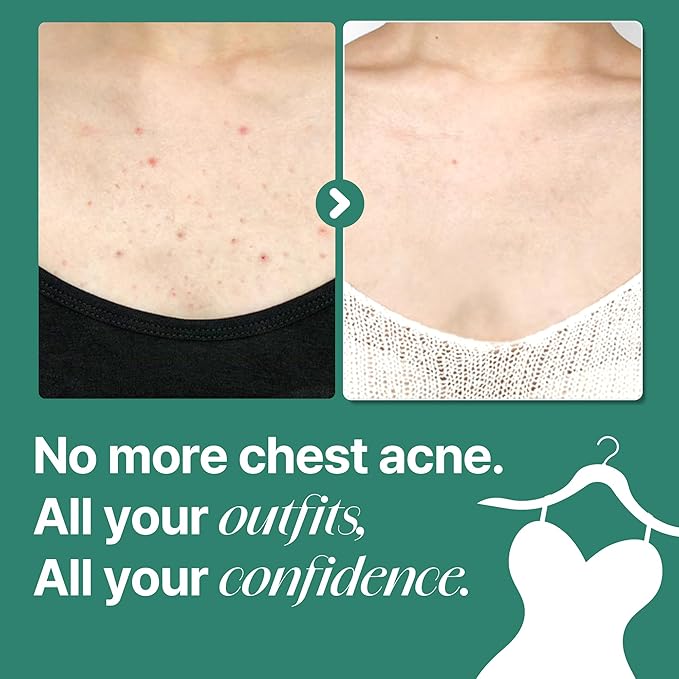 SOME BY MI AHA BHA PHA 30 Days Miracle Acne Clear Body Cleanser (Body Wash Big size - Pack of 1)
