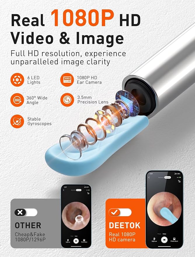 Ear Wax Removal Tool Camera - Ear Cleaner with 1080P HD Camera, FSA HSA Store Eligible, Otoscope with Light, Earwax Removal Kit with Replacement Tips for iPhone, iPad, Android Phones (Gray)