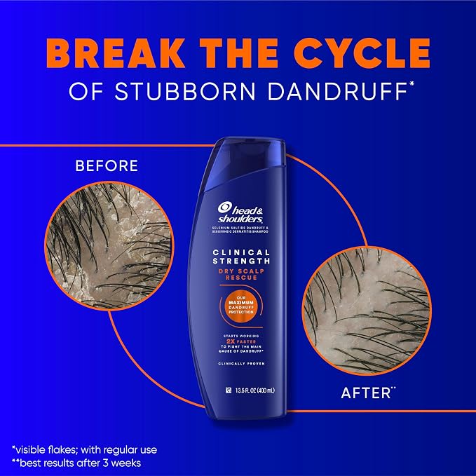 Head & Shoulders Anti-Dandruff Shampoo, Clinical Strength Dry Scalp Rescue, 1% Selenium Sulfide, Seborrheic Dermatitis Relief, Dry Scalp, 13.5 fl oz + Conditioner, 9.1oz
