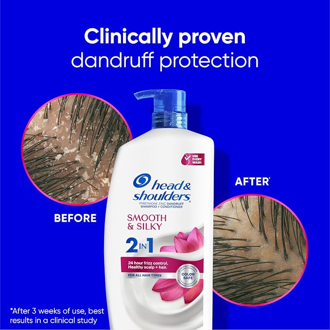 Head & Shoulders Anti-Dandruff Shampoo and Conditioner for Women | Smooth & Silky 2-in-1 | 1% Pyrithione Zinc, 24-Hour Frizz Control, Soothes Dry & Itchy Scalp, Healthy, Shiny & Smooth, 28.2 Fl Oz