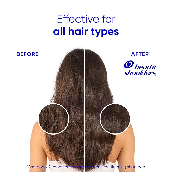 Head & Shoulders Anti-Dandruff Shampoo and Conditioner for Women | Smooth & Silky 2-in-1 | 1% Pyrithione Zinc, 24-Hour Frizz Control, Soothes Dry & Itchy Scalp, Healthy, Shiny & Smooth, 28.2 Fl Oz