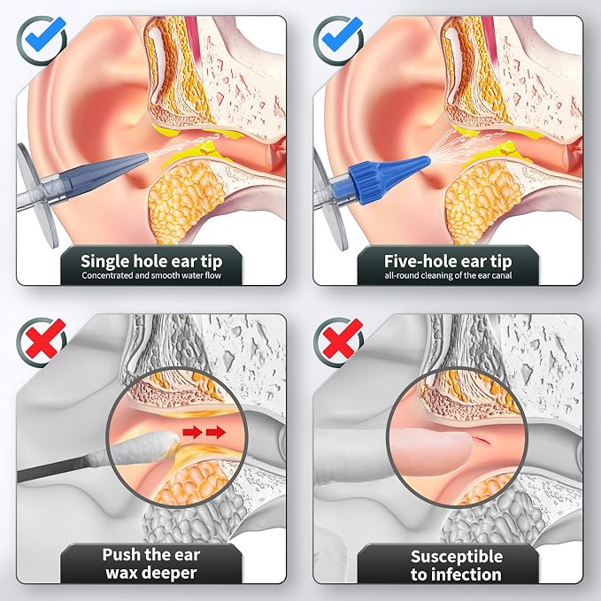 Ear Wax Removal, Ear Cleaner, Ear Wax Removal Kit, Ear Wax Removal Tool, Manual Ear Irrigation Flushing System, Ear Cleaning Kit for Adults & Kids