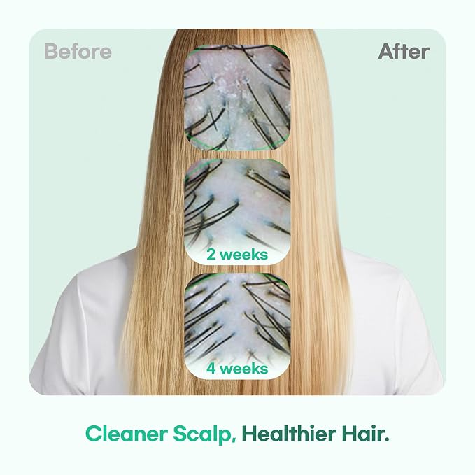TS GD Teen Shampoo for Itchy, Flaky, Dry, Sensitive Scalp, Sulfate and Silicone Free Gentle Scalp Cleanser for Build Up and Odor Care, Korean Hair Care 14.01 fl oz, 400ml